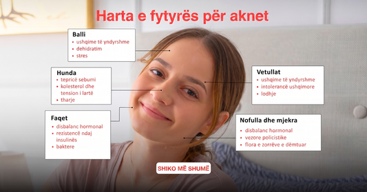 Harta e fytyrës për akne sipas zonave