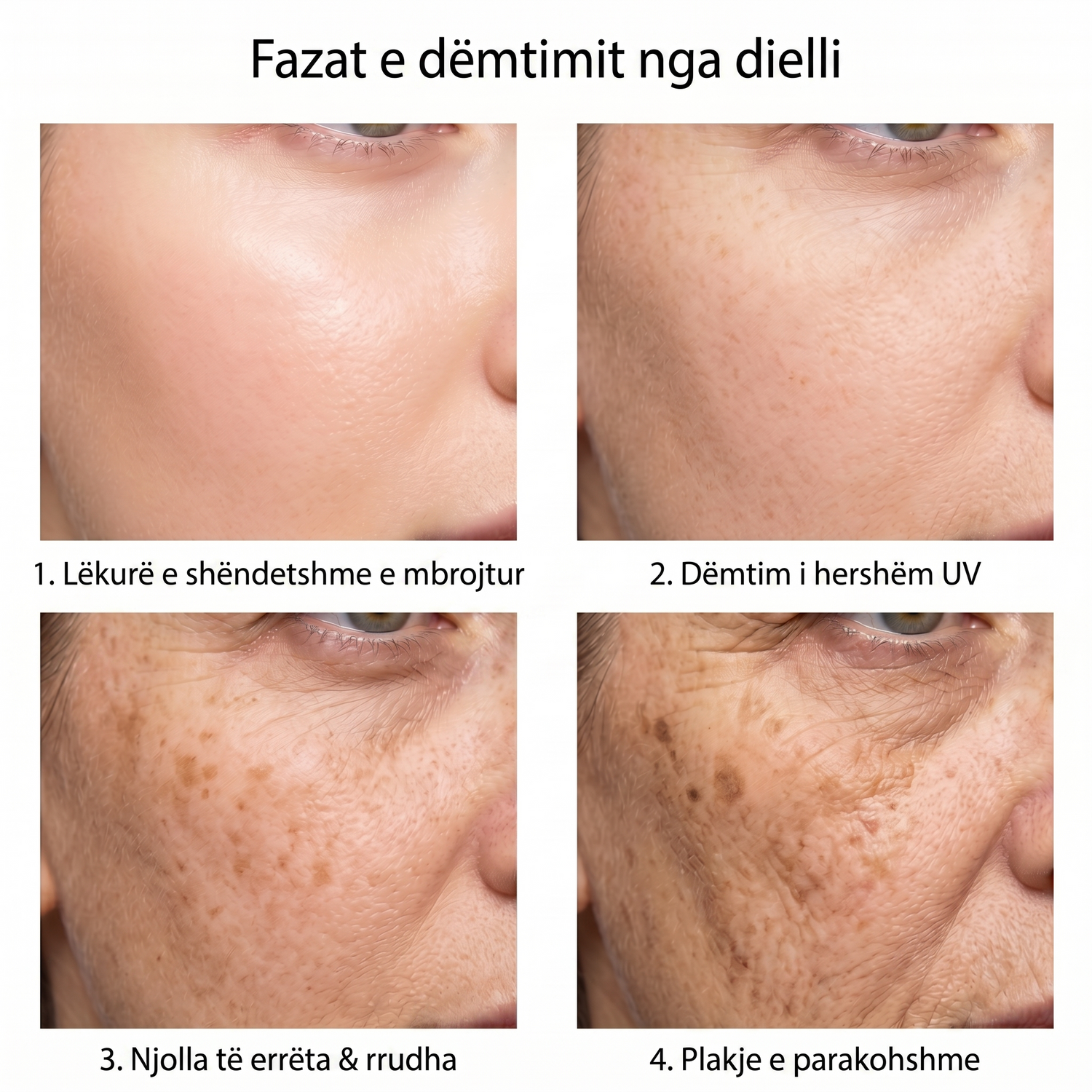 spf AL infographic